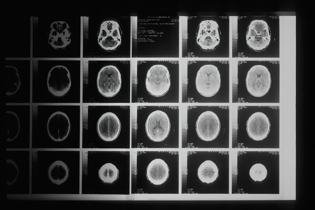 MRI vs CT vs X-Ray: What's Different?