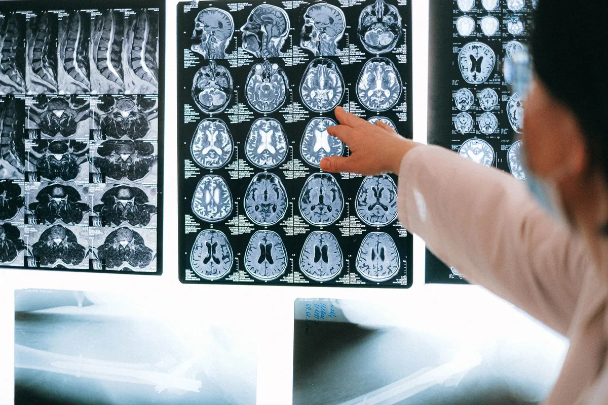 How Fast Do MRI Results Come Back?