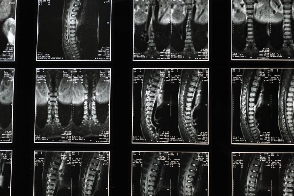affordable mri st. louis