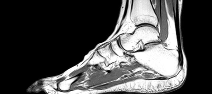 foot ankle mri